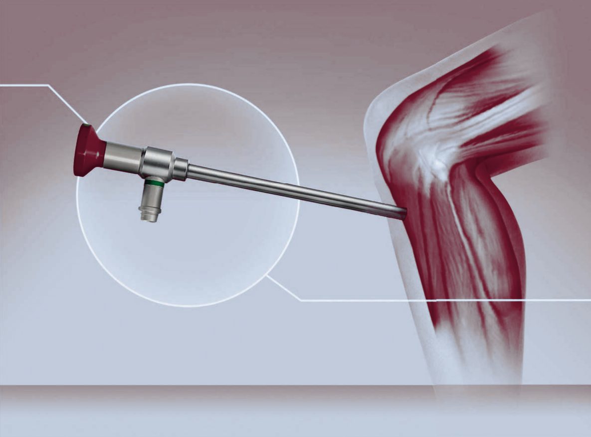 Arthroskopie – MAT Medical