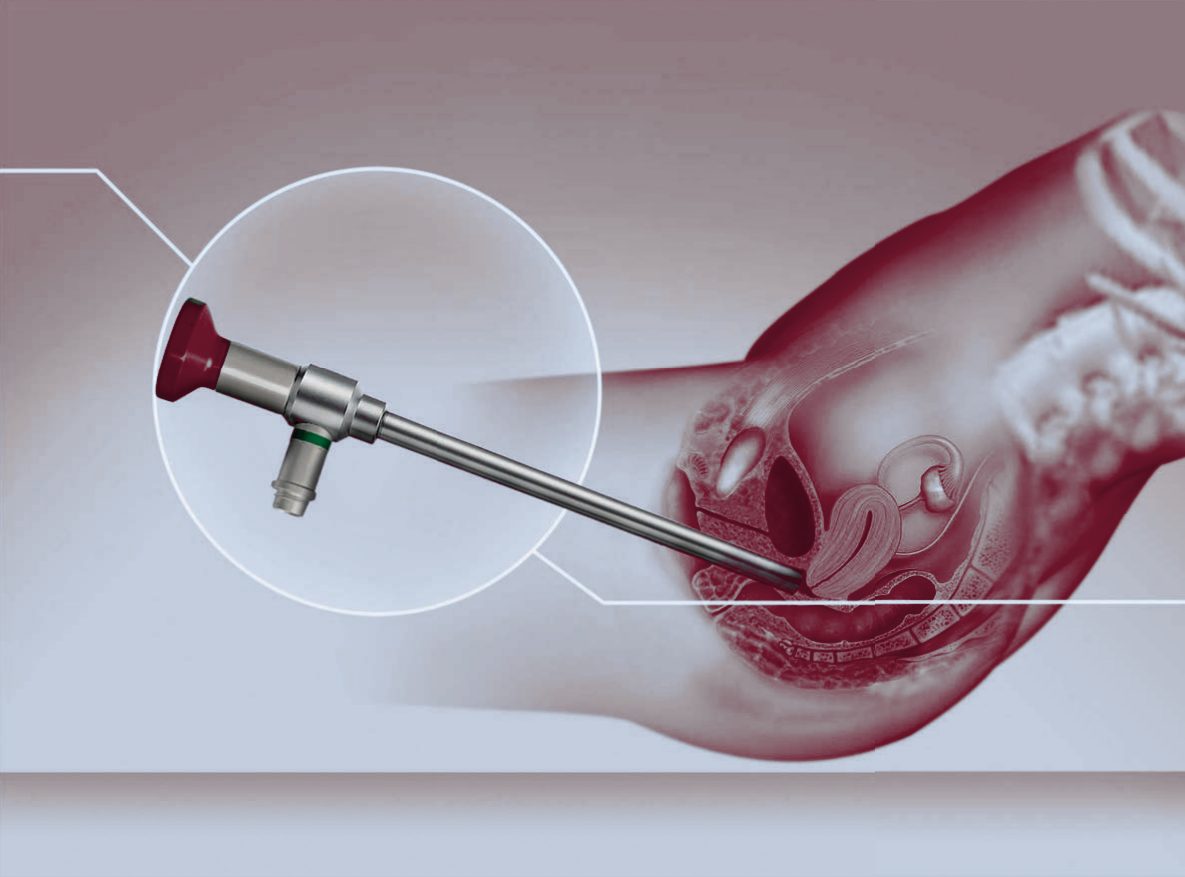 Hysteroskopie – MAT Medical