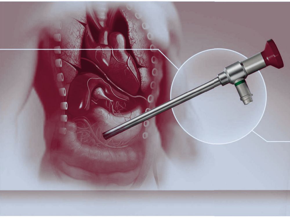 Laparoskopie – MAT Medical