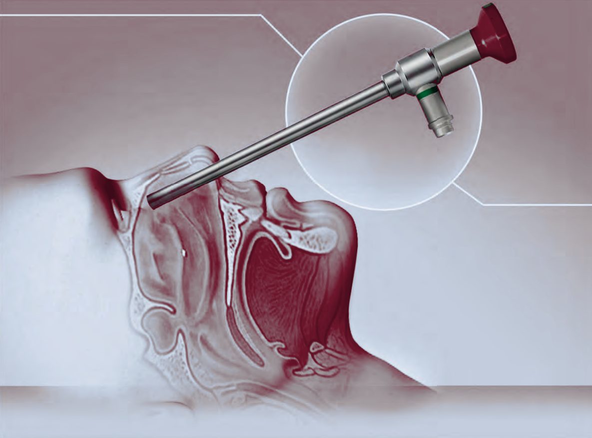 Sinuskopie (HNO) – MAT Medical