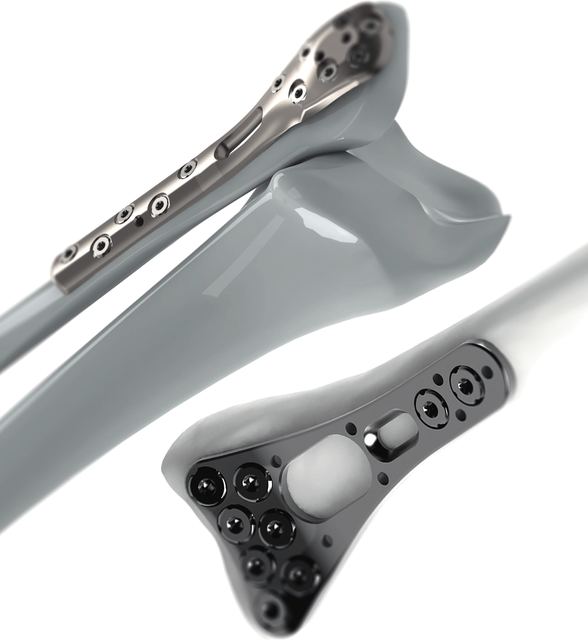 [ti]win Einweg-Implantatsets – MAT Medical