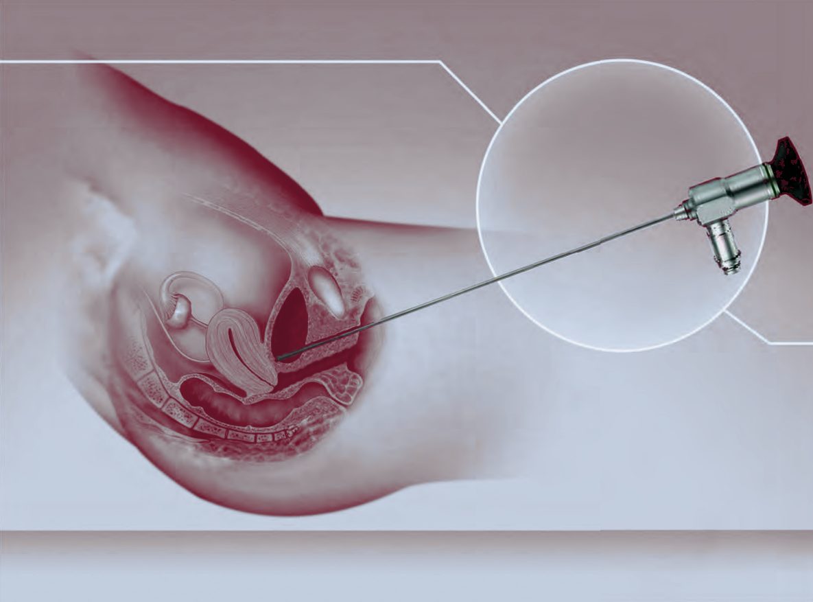 Urologie – MAT Medical